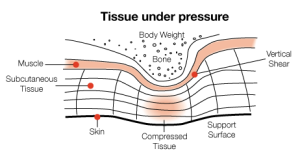 tissueunderpressure